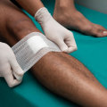 The Healing Power of Proper Wound Care