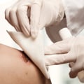 Navigating Your Treatment Options For A Denuded Skin Wound