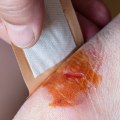 The Science Behind Wound Healing and the Best Options for Faster Recovery