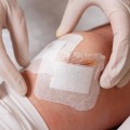 Are You Using Transparent Film Dressing the Right Way? The Ultimate Guide to Effective Wound Care