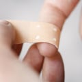 The Truth About Wound Care: To Cover or Not to Cover?