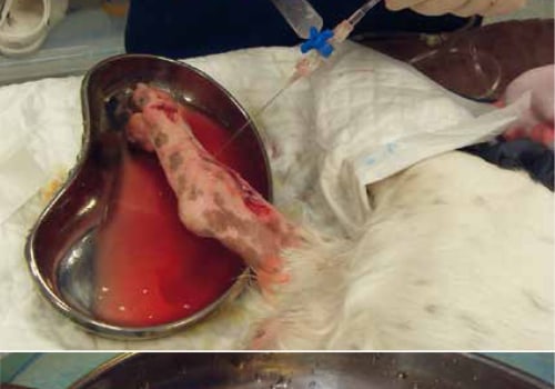 How The Mechanical Wound Debridement Procedure Aids In Effective Wound Treatment