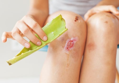 The Revolutionary Advances in Wound Healing