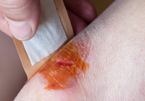 The Science Behind Wound Healing and the Best Options for Faster Recovery