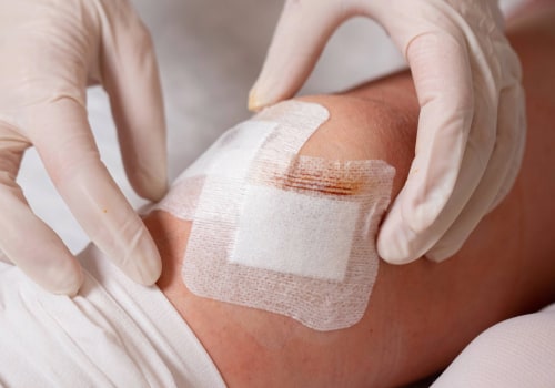 Are You Using Transparent Film Dressing the Right Way? The Ultimate Guide to Effective Wound Care