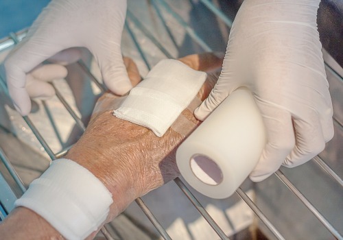 Preventing And Treating Moisture Associated Skin Damage in Wound Care